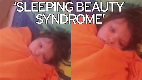 Sleeping Beauty Syndrome: Is It Genetic?